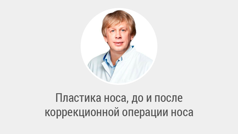 Пластика носа, до и после коррекционной операции носа - Левин Сергей Львович