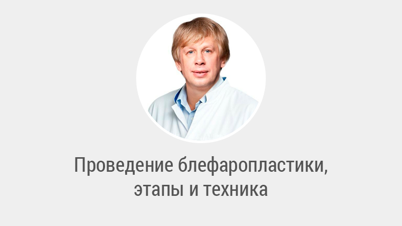 Проведение блефаропластики, этапы и техника - Левин Сергей Львович
