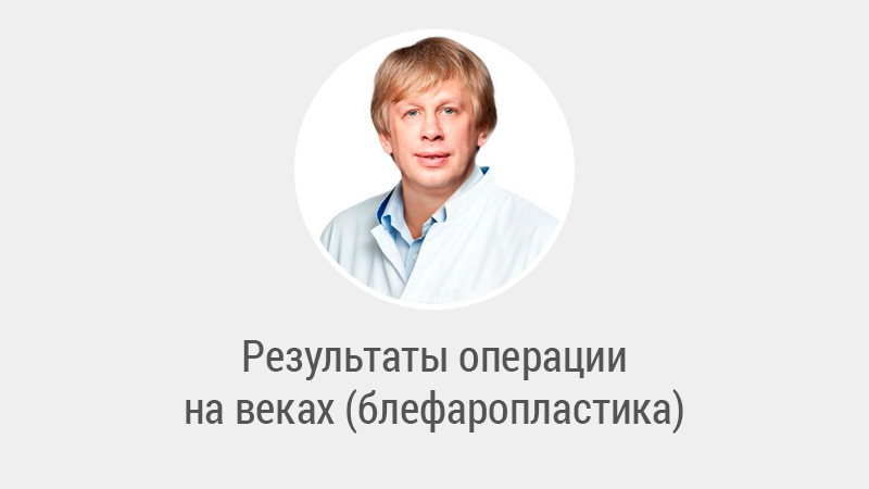 Результаты операции на веках - Левин Сергей Львович